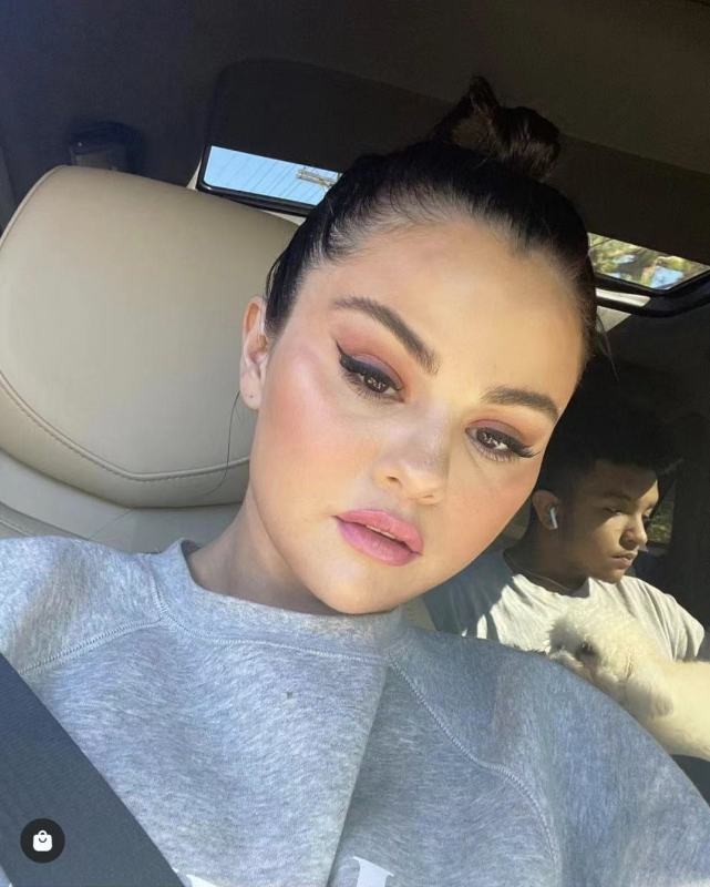 傻脸妹赛琳娜的颜值暴跌脸蛋浮肿显老十岁下垂眼袋太明显