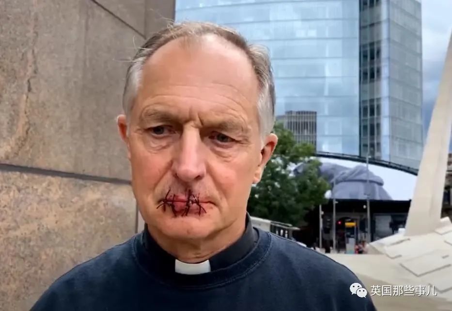 英国大爷亲手把自己嘴巴缝住,因为看不惯媒体大亨默多克?_腾讯新闻