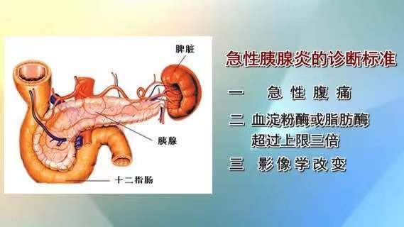 玉田县医院炎炎夏日好友聚会不得不防急性胰腺炎