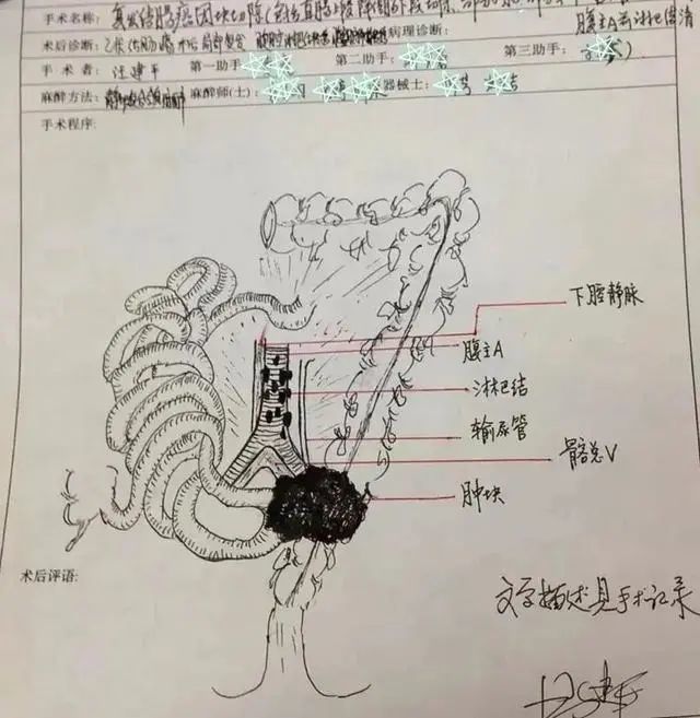 空肠手绘图图片