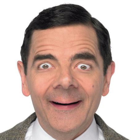 云南中西医结合医院甲状腺专科:甲亢突眼5大典型症状,建议深入了解