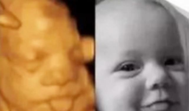 四维中的胎儿和生出来的胎儿,会一样吗?过来人:实物和图片不符