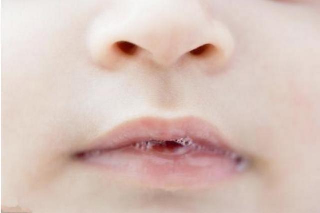 宝宝总爱流口水?除了5个常见原因,这3个"特殊"原因也要注意