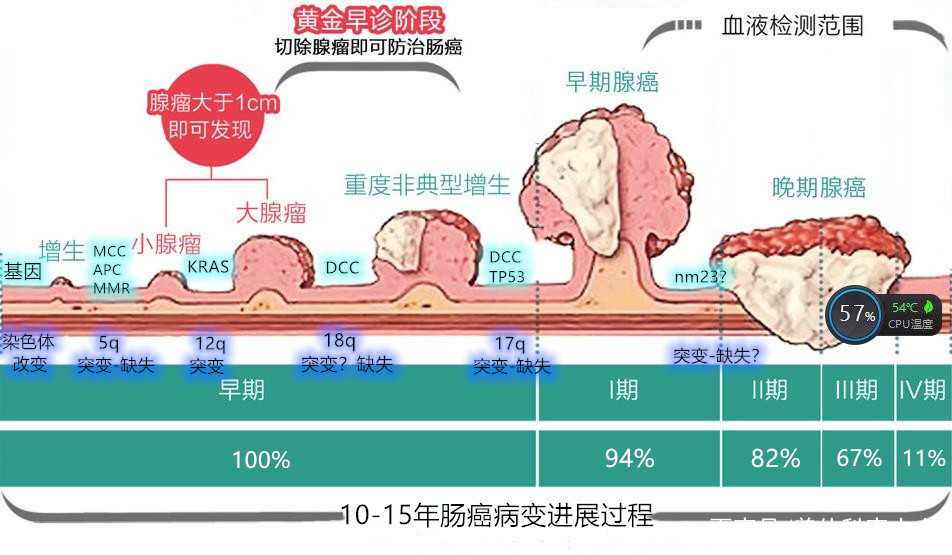 肠癌病变过程