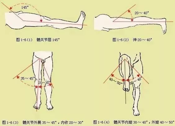 度常會減小,出現髖關節的活動功能受限,這個時候需要進一步的臨床檢查