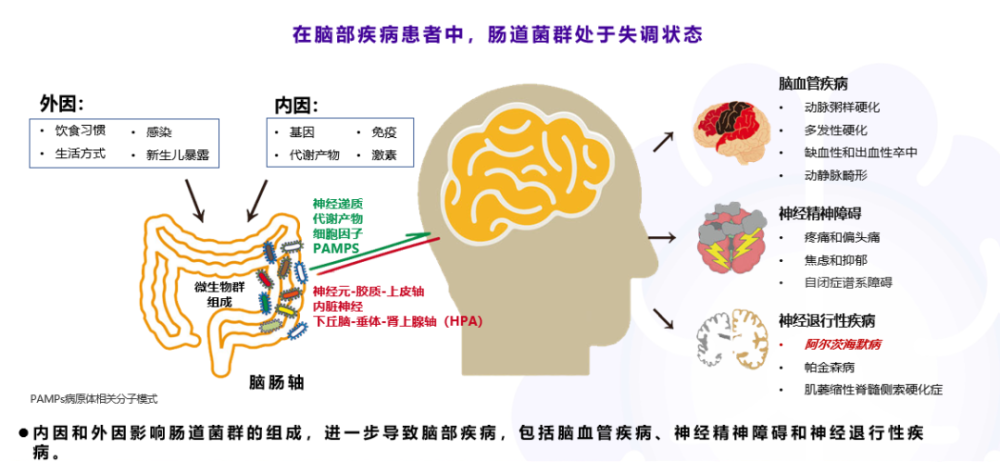 腸道菌群阿爾茨海默病研究與治療的新方向