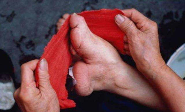 明代,妇女缠足之风进入兴盛时期,并在各地迅速发展.