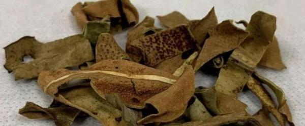 医生提醒:若咳出这5类痰液,或是肺部在"求救",莫忽视