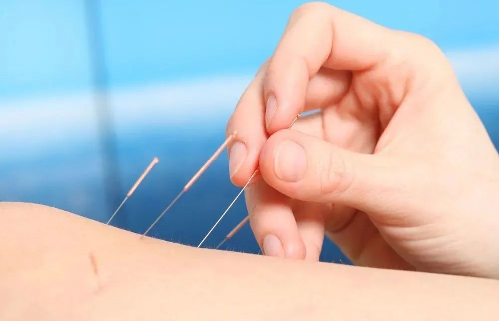 针灸歌诀经典好文