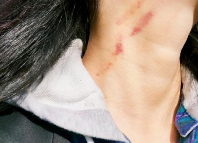 过了十一天,新宾镇一个名叫康丽的女人脸部被杨洪军割伤,当他想杀害