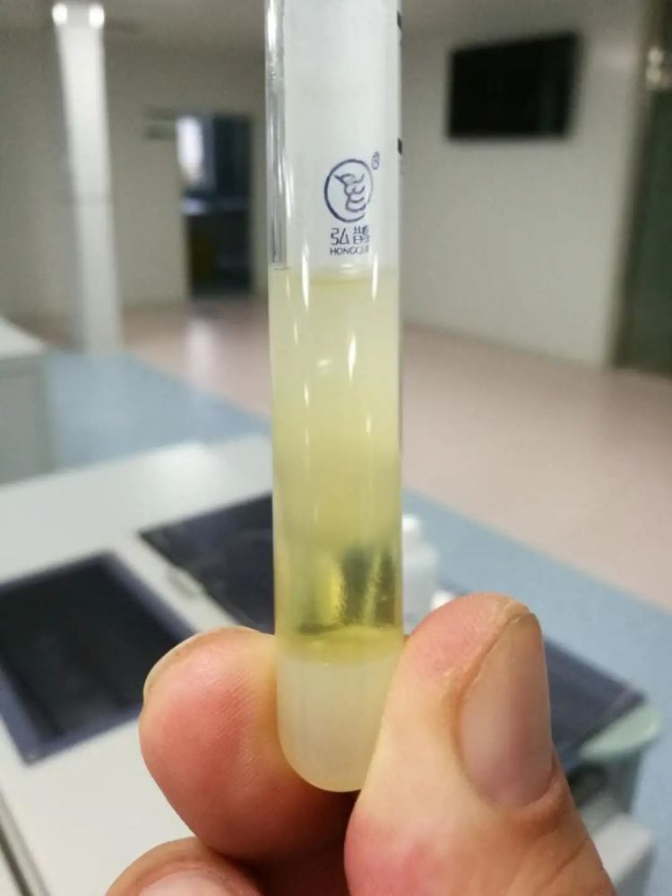 由血钙假性升高引发的思考|全国检验与临床思维案例