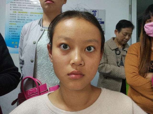 昆明中研甲状腺医院什么人更容易得甲亢甲亢是怎么引起的