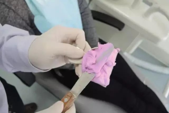 正畸取模藻酸盐使用技巧