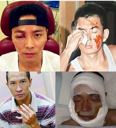 吴磊被烫伤,赵露思被抓伤,明星光鲜亮丽下的心酸另一面