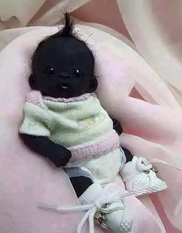 最可怕的连体婴图片