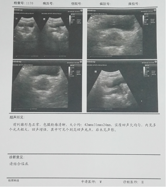 这位患者的前列腺b超可见他的前列腺形态正常,包膜轮廓清晰,大小约42*