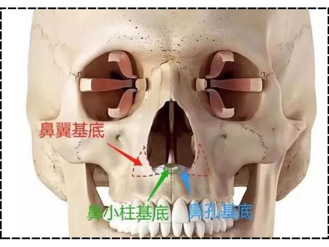 丨科普篇|假體|鼻小柱|法令紋|自體脂肪|鼻子