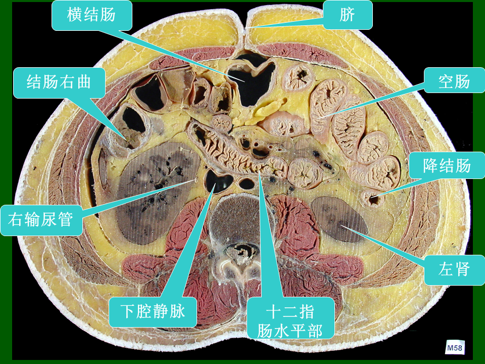 高清人体腹部断层解剖图谱,必须收藏_腾讯新闻