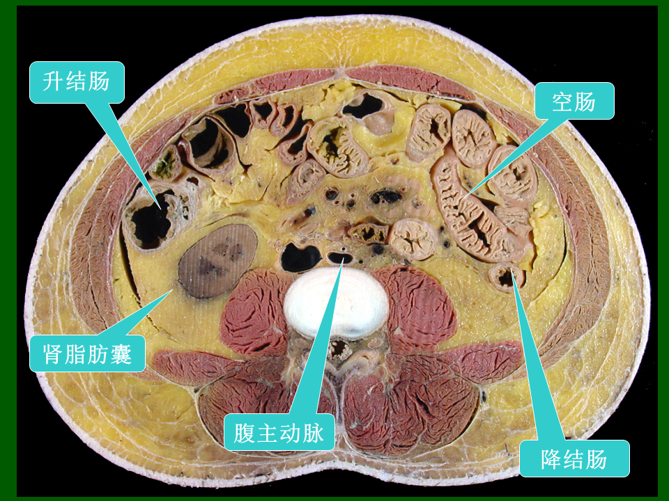 高清人體腹部斷層解剖圖譜,必須收藏_騰訊新聞
