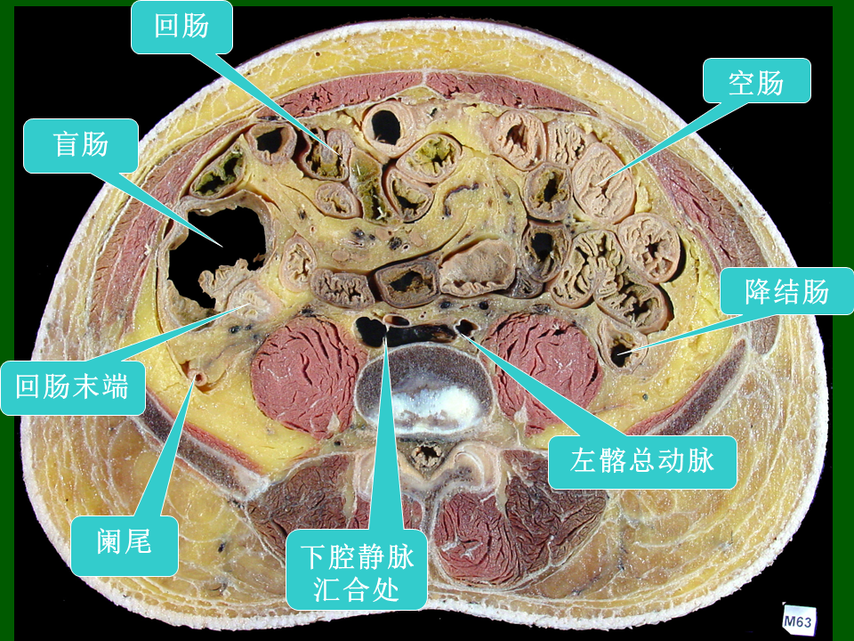 高清人体腹部断层解剖图谱,必须收藏_腾讯新闻