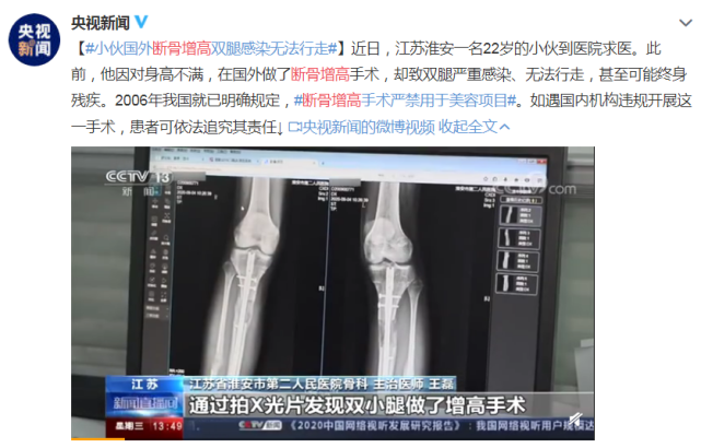 成年人还能不能长高？一文揭开增高针、增高药的真相_腾讯新闻