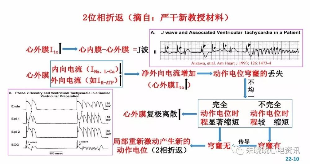 恶性室性心律失常发生机制