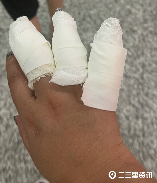 辽阳女子炸香肠手指杵进油锅邻居纷纷支招儿有的真不能做