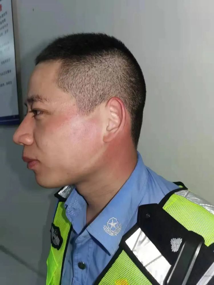 "口罩脸" "熊猫臂" .