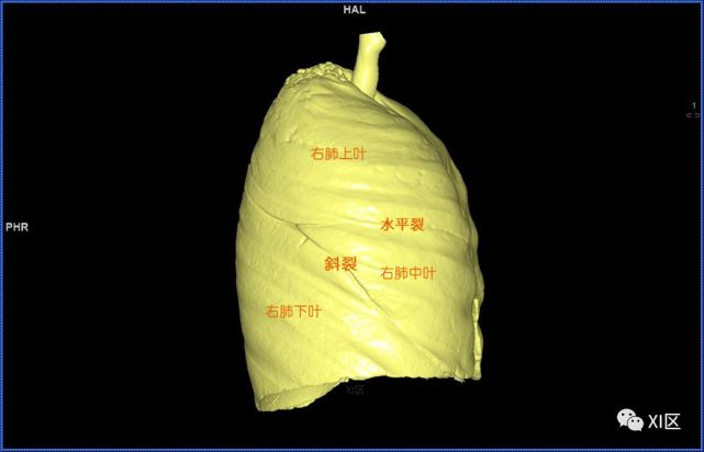 肺的分葉氣管支氣管樹與兩肺融合顯示前後位,雙側位,後前位顯示氣道肺