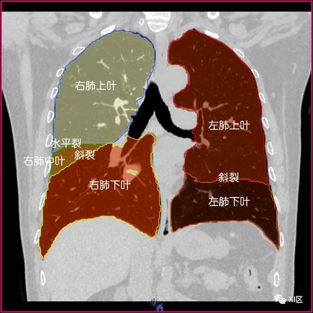 如此详细的肺部影像解剖,有点儿酷!
