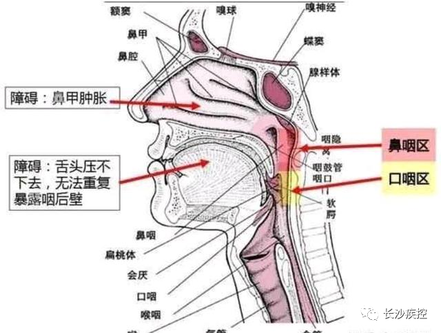 正常的鼻咽部平面图片图片