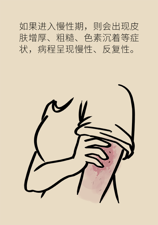 一到夏天痒痒痒!湿疹反反复复,祛湿到底有用吗?_腾讯新闻