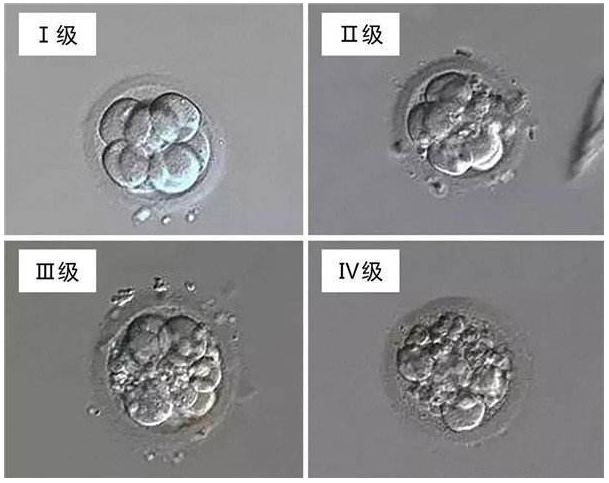 胚胎等级
