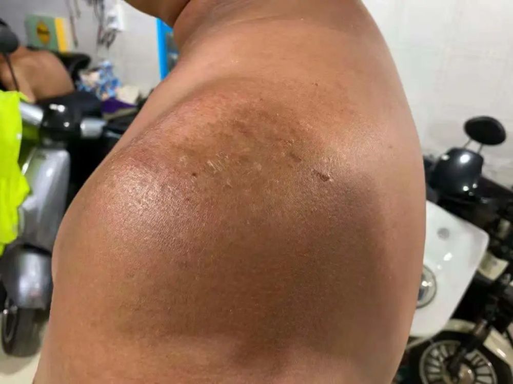 还有这默默承受的肩膀她是卫辉市公安局交警大队辅警柳莎,由于每天在