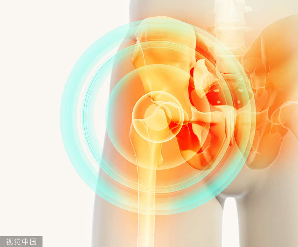 走路,抬腿时,髋关节发出响声是什么原因?平时怎样预防和锻炼?