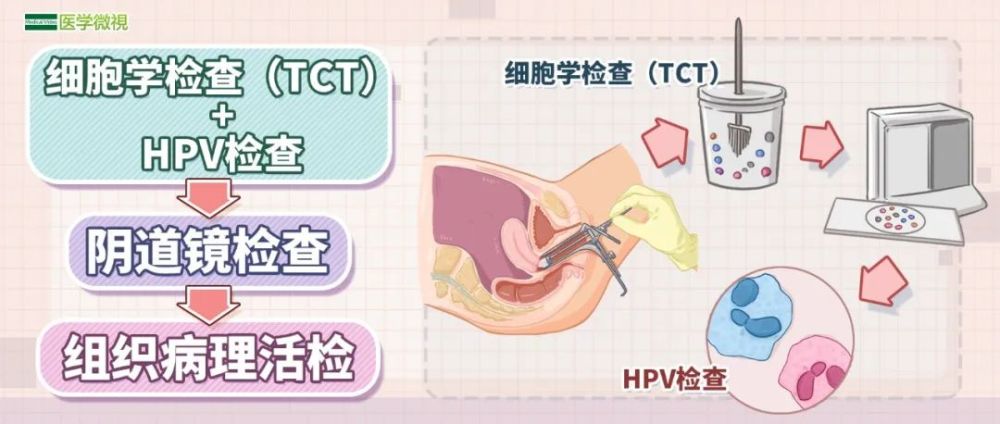 一篇文章,看懂宫颈癌tct检查的10种结果!_腾讯新闻