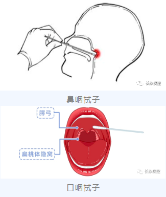 留取咽拭子位置图片图片