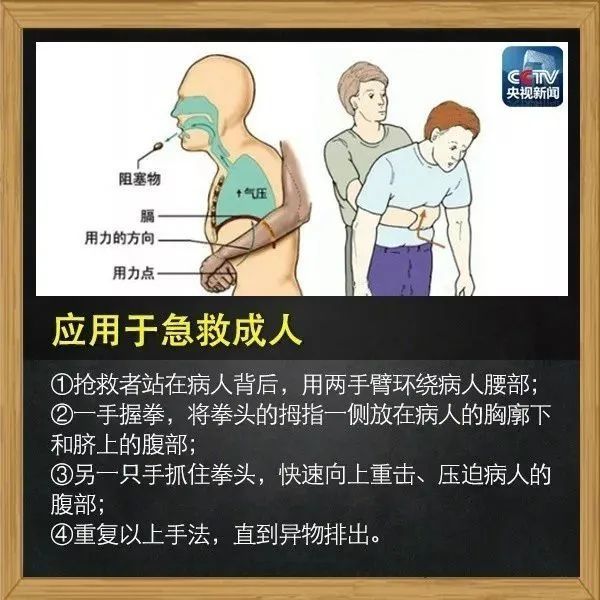 幼童异物卡喉陌生小伙拨开人群上演生死急救孩子家长跪地感谢