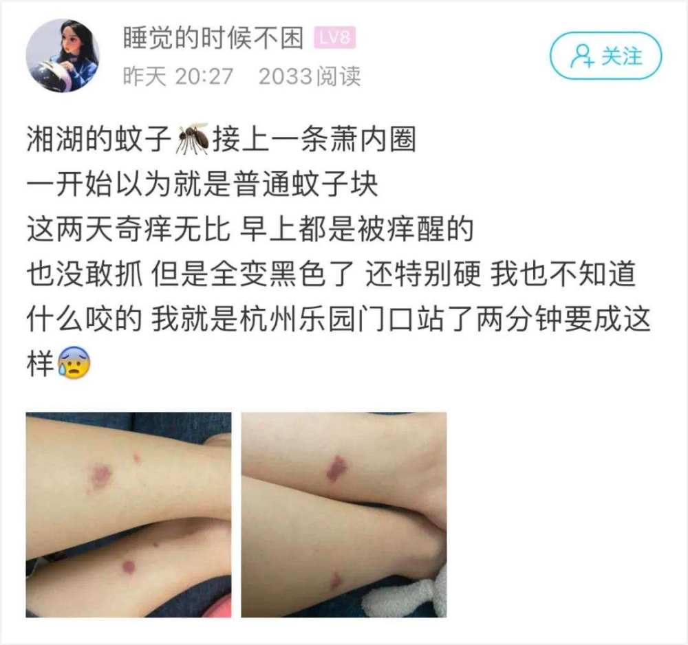 姑娘被咬後奇癢無比,兩天後包塊變黑變硬,網友:不是蚊子咬的_騰訊新聞