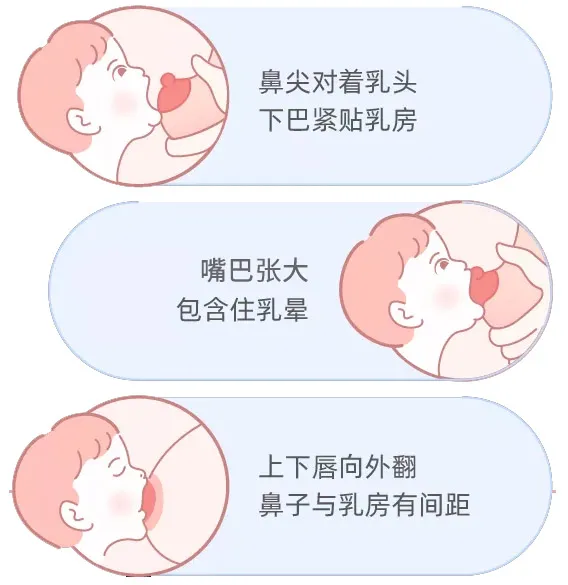 正确的衔乳需要宝宝上下唇外翻,抵住乳晕边缘,并含住乳头和大部分乳晕