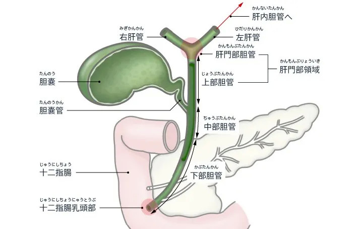 胆管扩张症的病因非常复杂,目前能确定的病因主要有遗传因素,胰胆管合