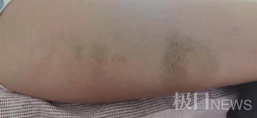 军尚少年军校暴力夏令营：河北三少年被殴写纸条求救(图15)
