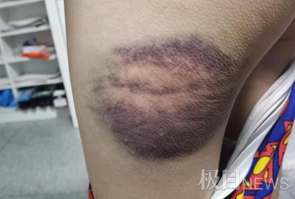 军尚少年军校暴力夏令营：河北三少年被殴写纸条求救(图6)