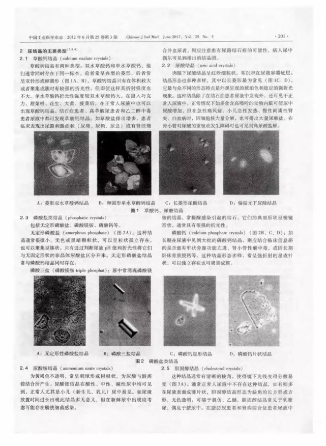 尿路結石患者的尿液中出現大量尿液結晶竟是因為這個原因