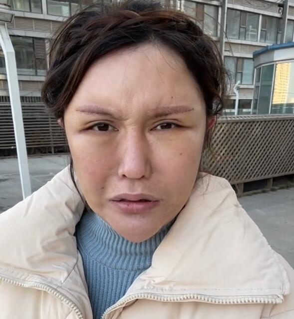网红美娜分享近百次整容经历花了这么多钱还是这熊样