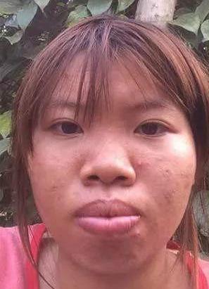 越南凤姐郭金凤:花9万整容后嫁富二代,女儿颜值成亮点|整容|凤姐|相亲