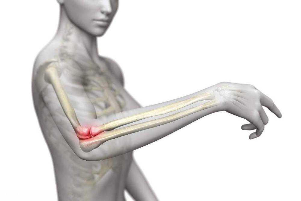 肱骨外上髁炎的临床表现