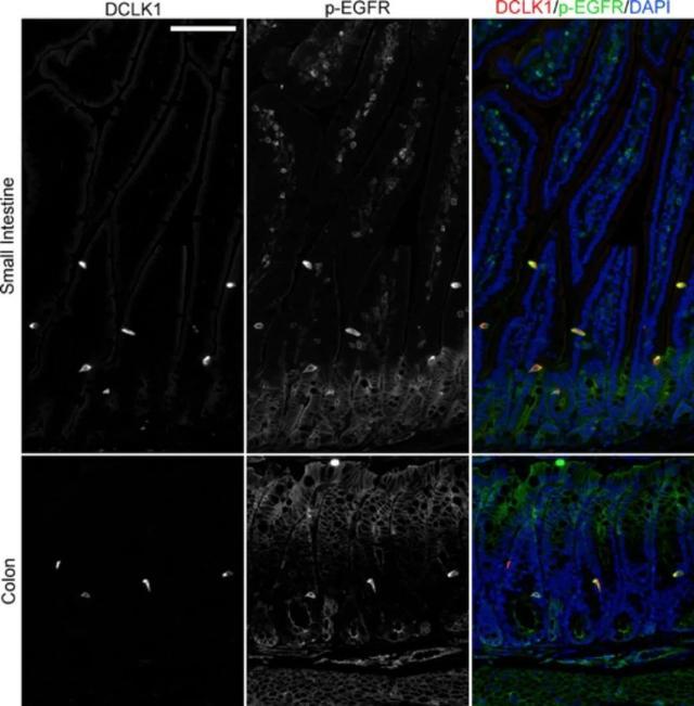 圖2小鼠小腸和結腸p-egfr染色
