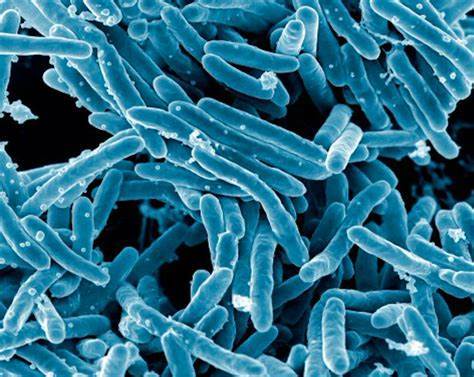 特别是面部,颈肩部,手脚,这些暴露于外面的皮肤很容易被炭疽杆菌侵袭.