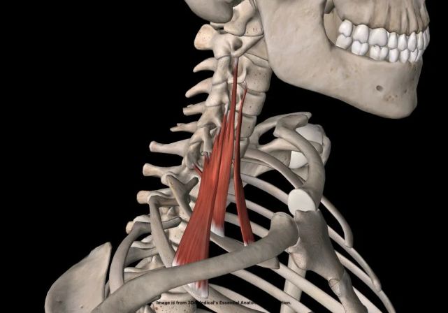 前斜角肌综合征的发生机制和治疗